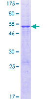 ETFBKMT Protein - 12.5% SDS-PAGE of human MGC50559 stained with Coomassie Blue