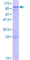 ETFDH Protein - 12.5% SDS-PAGE of human ETFDH stained with Coomassie Blue