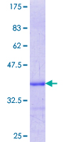 ETFDH Protein - 12.5% SDS-PAGE Stained with Coomassie Blue.