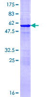 ETHE1 Protein - 12.5% SDS-PAGE of human ETHE1 stained with Coomassie Blue