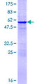 ETHE1 Protein - 12.5% SDS-PAGE of human ETHE1 stained with Coomassie Blue