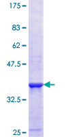 ETHE1 Protein - 12.5% SDS-PAGE Stained with Coomassie Blue.