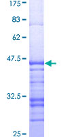 ETK / BMX Protein - 12.5% SDS-PAGE Stained with Coomassie Blue.