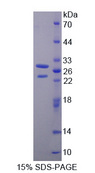 ETK / BMX Protein - Recombinant  BMX Non Receptor Tyrosine Kinase By SDS-PAGE