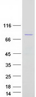 ETK / BMX Protein - Purified recombinant protein BMX was analyzed by SDS-PAGE gel and Coomassie Blue Staining