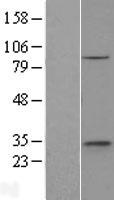 ETNK1 / Ethanolamine Kinase 2 Protein - Western validation with an anti-DDK antibody * L: Control HEK293 lysate R: Over-expression lysate