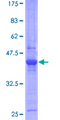 ETNK1 / Ethanolamine Kinase 2 Protein - 12.5% SDS-PAGE of human ETNK1 stained with Coomassie Blue