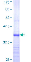 ETNK1 / Ethanolamine Kinase 2 Protein - 12.5% SDS-PAGE Stained with Coomassie Blue.