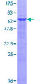 ETNK2 Protein - 12.5% SDS-PAGE of human ETNK2 stained with Coomassie Blue
