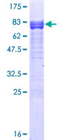 ETS1 / ETS-1 Protein - 12.5% SDS-PAGE of human ETS1 stained with Coomassie Blue