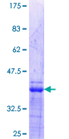 ETS1 / ETS-1 Protein - 12.5% SDS-PAGE Stained with Coomassie Blue.