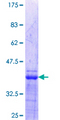 ETS1 / ETS-1 Protein - 12.5% SDS-PAGE Stained with Coomassie Blue.