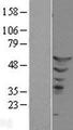 ETS2 Protein - Western validation with an anti-DDK antibody * L: Control HEK293 lysate R: Over-expression lysate