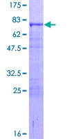 ETS2 Protein - 12.5% SDS-PAGE of human ETS2 stained with Coomassie Blue