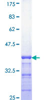 ETS2 Protein - 12.5% SDS-PAGE Stained with Coomassie Blue.