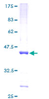 ETV3 Protein - 12.5% SDS-PAGE of human ETV3 stained with Coomassie Blue