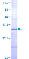 ETV3 Protein - 12.5% SDS-PAGE Stained with Coomassie Blue.