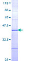 ETV3 Protein - 12.5% SDS-PAGE Stained with Coomassie Blue.