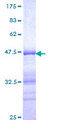 ETV5 / ERM Protein - 12.5% SDS-PAGE Stained with Coomassie Blue.