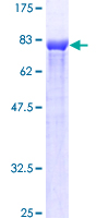 ETV6 / TEL Protein - 12.5% SDS-PAGE of human ETV6 stained with Coomassie Blue