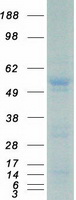 ETV6 / TEL Protein - Purified recombinant protein ETV6 was analyzed by SDS-PAGE gel and Coomassie Blue Staining