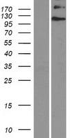 EVC / DWF-1 Protein - Western validation with an anti-DDK antibody * L: Control HEK293 lysate R: Over-expression lysate