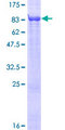 EVC / DWF-1 Protein - 12.5% SDS-PAGE of human EVC stained with Coomassie Blue