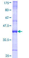 EVC / DWF-1 Protein - 12.5% SDS-PAGE Stained with Coomassie Blue.