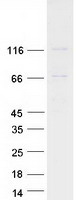 EVC / DWF-1 Protein - Purified recombinant protein EVC was analyzed by SDS-PAGE gel and Coomassie Blue Staining