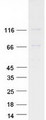 EVC / DWF-1 Protein - Purified recombinant protein EVC was analyzed by SDS-PAGE gel and Coomassie Blue Staining