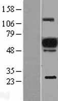EVI2A Protein - Western validation with an anti-DDK antibody * L: Control HEK293 lysate R: Over-expression lysate