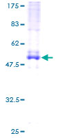 EVI2A Protein - 12.5% SDS-PAGE of human EVI2A stained with Coomassie Blue