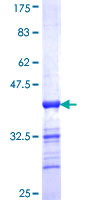 EVI2B Protein - 12.5% SDS-PAGE Stained with Coomassie Blue.