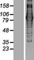 EVI5L Protein - Western validation with an anti-DDK antibody * L: Control HEK293 lysate R: Over-expression lysate