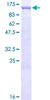EVI5L Protein - 12.5% SDS-PAGE of human EVI5L stained with Coomassie Blue