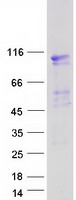 EVI5L Protein - Purified recombinant protein EVI5L was analyzed by SDS-PAGE gel and Coomassie Blue Staining