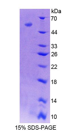 EVPL / Envoplakin Protein - Recombinant  Envoplakin By SDS-PAGE