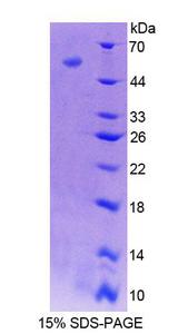 EVPL / Envoplakin Protein - Recombinant  Envoplakin By SDS-PAGE