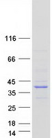 EVPLL Protein - Purified recombinant protein EVPLL was analyzed by SDS-PAGE gel and Coomassie Blue Staining