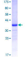 EWSR1 / EWS Protein - 12.5% SDS-PAGE Stained with Coomassie Blue.