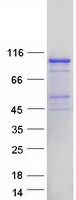 EXD3 Protein - Purified recombinant protein EXD3 was analyzed by SDS-PAGE gel and Coomassie Blue Staining