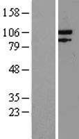 EXO1 Protein - Western validation with an anti-DDK antibody * L: Control HEK293 lysate R: Over-expression lysate