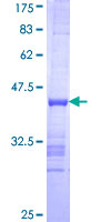 EXO1 Protein - 12.5% SDS-PAGE Stained with Coomassie Blue.