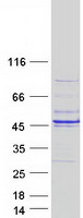 EXO5 / Exonuclease 5 Protein - Purified recombinant protein EXO5 was analyzed by SDS-PAGE gel and Coomassie Blue Staining