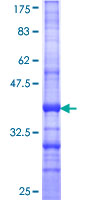 EXOC1 / SEC3 Protein - 12.5% SDS-PAGE Stained with Coomassie Blue.