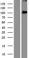 EXOC2 / SEC5 Protein - Western validation with an anti-DDK antibody * L: Control HEK293 lysate R: Over-expression lysate
