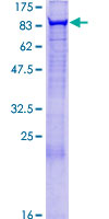 EXOC3 / SEC6 Protein - 12.5% SDS-PAGE of human EXOC3 stained with Coomassie Blue
