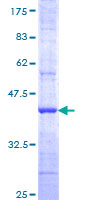 EXOC3 / SEC6 Protein - 12.5% SDS-PAGE Stained with Coomassie Blue.