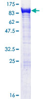 EXOC5 Protein - 12.5% SDS-PAGE of human EXOC5 stained with Coomassie Blue