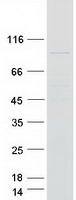 EXOC6 / SEC15 Protein - Purified recombinant protein EXOC6 was analyzed by SDS-PAGE gel and Coomassie Blue Staining